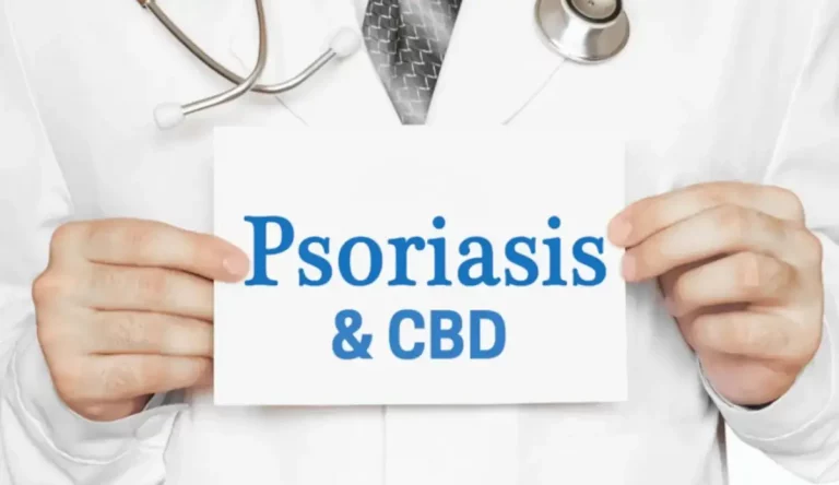 CBD y psoriasis